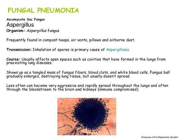 Fungal Pneumonias
