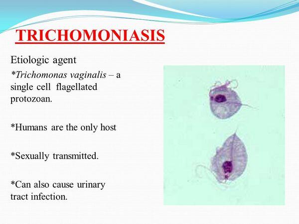 Sexually Transmitted Diseases: Trichomoniasis