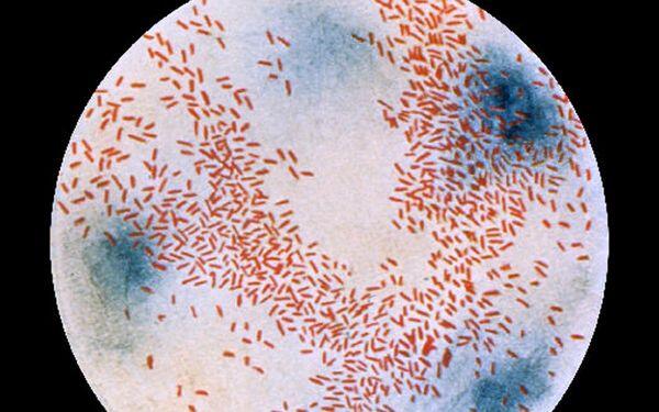 Haemophilus influenzae