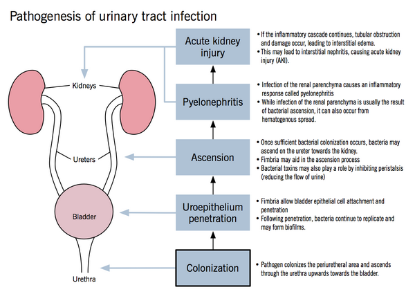 Urinary tract infection