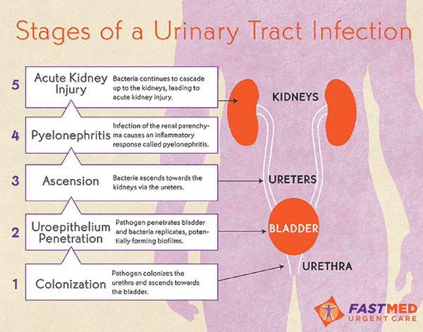 Urinary tract infection